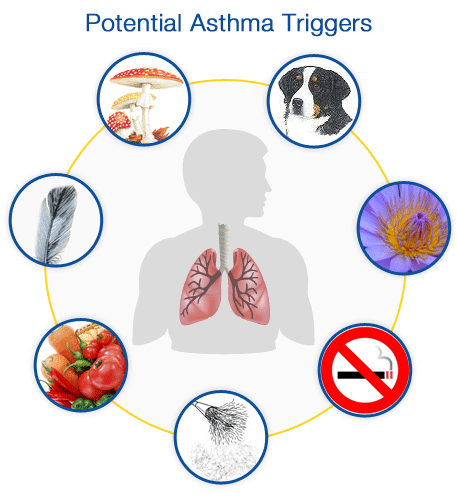 Razumevanje Okidaca Astme